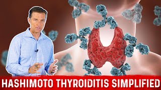 Symptoms of Low Thyroid That Often Get Overlooked Dr Hagmeyer [upl. by Brooks]