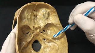 Skull Osteology  Cranial Cavity Anatomy [upl. by Sifan651]