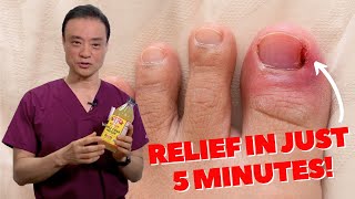 6 HOME REMEDIES To Treat A PAINFUL Ingrown Nail  Dr Kim [upl. by Adnirual]