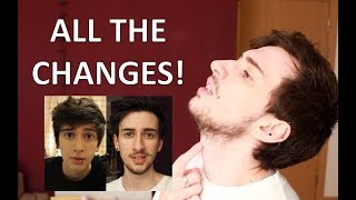 FTM Trans Guy Everything Testosterone Changes [upl. by Erickson]