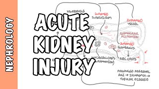 Acute Kidney Injury AKI  prerenal intrarenal and postrenal causes and pathophysiology [upl. by Polivy]