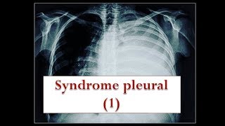 le syndrome pleural partie 1 [upl. by Hsima]