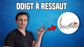 SOLUTIONS CONTRE LE DOIGT À RESSAUT  EXPLICATION ET EXERCICES KINÉ [upl. by Aiepoissac]