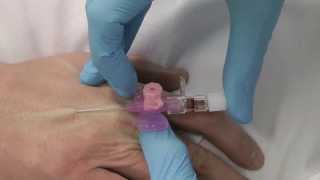 Cannulation How to gain IV access [upl. by Ayekel]