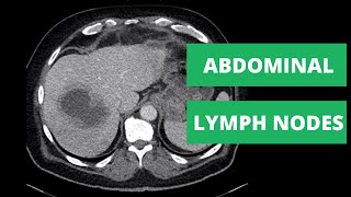 Abdominal CT Lymph Node Stations  How to read a CT [upl. by Brazee]