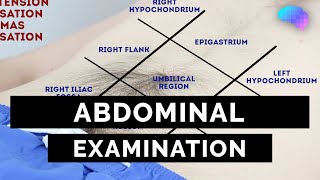 Abdominal Examination  OSCE Guide Latest  UKMLA  CPSA  PLAB 2 [upl. by Aneehta]