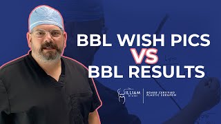 BBL Wish Pics vs BBL Results [upl. by Seamus]