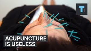 Acupuncture is useless [upl. by Aratas]