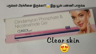 clinsol gel review in tamil [upl. by Calida]