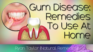 Natural Remedies for Gum Disease Home Treatment [upl. by Sandon786]