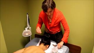 Acupuncture Demonstration and Benefits [upl. by Diad]