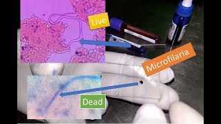 Microfilaria live and dead under Microscope [upl. by Restivo721]