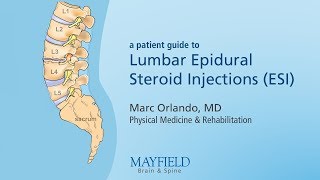 Lumbar Epidural Steroid Injections [upl. by Ailet]