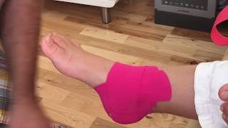 How to Apply Kinesiology Tape for Medial Ankle Sprain [upl. by Henebry]