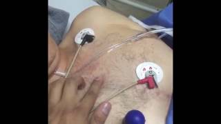 ¿Cómo hago un Electrocardiograma ¡En emergencias [upl. by Emya]