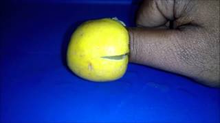 how to remove pus from fingers  Paronychia [upl. by Seligmann827]