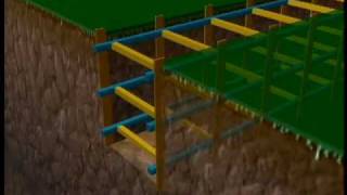 How to Measure Wound Depth with Slough and Eschar in the Way [upl. by Ralyks]