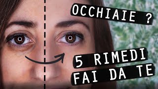 COME TOGLIERE le OCCHIAIE FAI DA TE 🐼👀 [upl. by Suoirrad]