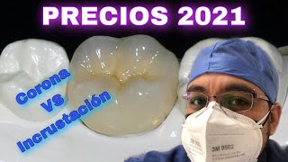 CORONA vs INCRUSTACION  ¿Cuanto cuestan en 2021 [upl. by Ahsinotna]