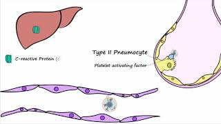 Bacterial Pneumonia  Pathogenesis [upl. by Aynas]