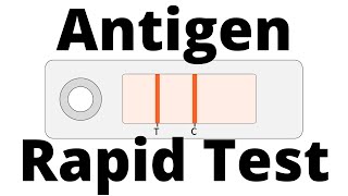 How SARSCoV2 Antigen Rapid Tests work Covid19 Testing [upl. by Etteloc]