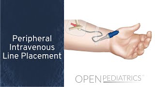 Peripheral Intravenous Line Placement by B Johnson L DelSignore  OPENPediatrics [upl. by Artinak]