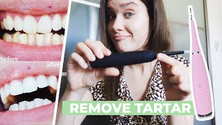 HOW TO REMOVE CALCULUS TARTAR PLAQUE AT HOME  Ultrasonic Tooth Cleaner Review  Does It Work [upl. by Acined404]