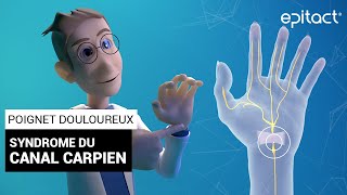 Syndrome du Canal Carpien  Explications – EPITACT [upl. by Takeshi]