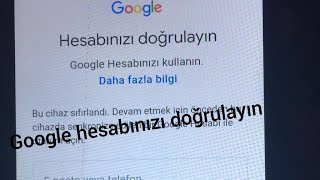 Bu cihaz sıfırlandı Gmail şifremi unuttum \u00100 çözüm [upl. by Lehcim911]