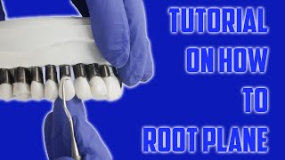 Dental Root Planing 101  StepbyStep [upl. by Syl965]