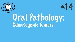 LUNG CANCER  Part 2 Morphology Clinical features [upl. by Cyprian]