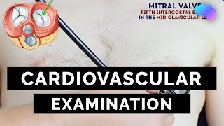 Cardiovascular Examination  OSCE Guide  UKMLA  CPSA  PLAB 2 [upl. by Oliy]