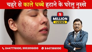 Black spots on skin and its natural remedies  Dr Bimal Chhajer  SAAOL [upl. by Hsirt]