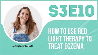 How to use red light therapy to treat eczema  The Eczema Podcast S3E10 [upl. by Fonseca]