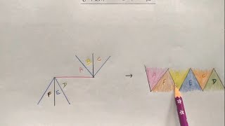 How to Suture  part 4 the Z plasty [upl. by Tench]