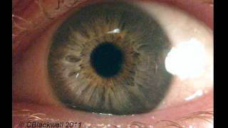 Eye Works 1 Focusing Cornea Iris and Lens [upl. by Emeline]