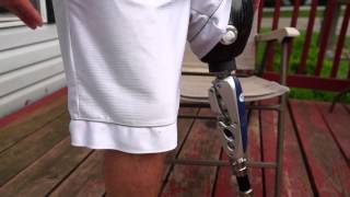 AmputeeOT How An Above Knee AK Prosthetic Leg Works [upl. by Luann]