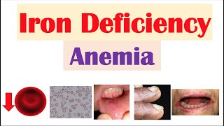 Assessing for Signs of Anaemia [upl. by Malek546]