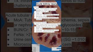 Acute kidney injury [upl. by Melissa]