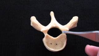 Typical Vertebra  Spinal column  Anatomy [upl. by Millham]