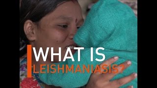 What is Leishmaniasis [upl. by Odlavso91]