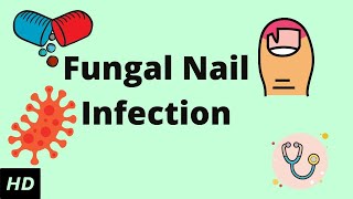 Fungal Nail Infection Causes Signs and Symptoms Diagnosis and Treatment [upl. by Ahseiat]