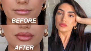 HOW TO FAKE BIG LIPS IN 3 EASY STEPS OMG [upl. by Eanil]