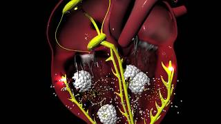 Digoxin for Arrhythmias irregular heartbeat [upl. by Waldack]