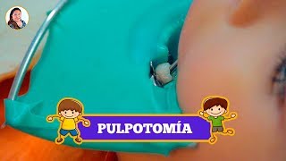 PULPOTOMÍA para NIÑOS 👦🏻  ODONTOPEDIATRÍA 😀  CLÍNICA DENTAL Hada 🧚🏻 [upl. by Leinod227]