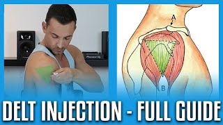 How To Do A Deltoid Injection  Full GuideDemo [upl. by Eward]