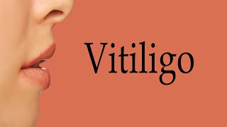 How To Say Vitiligo [upl. by Jone337]