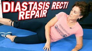 Top 5 Exercises to REPAIR Diastasis Recti [upl. by Indnahc280]