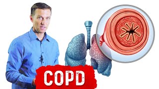 Chronic Obstructive Pulmonary Disease COPD [upl. by Ocirrej]