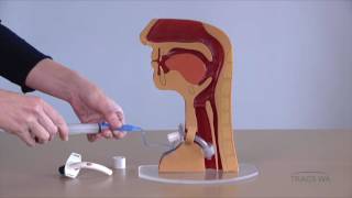 Tracheostomy  Respiratory phonatory and swallowing function  TRACS WA [upl. by Eirhtug]